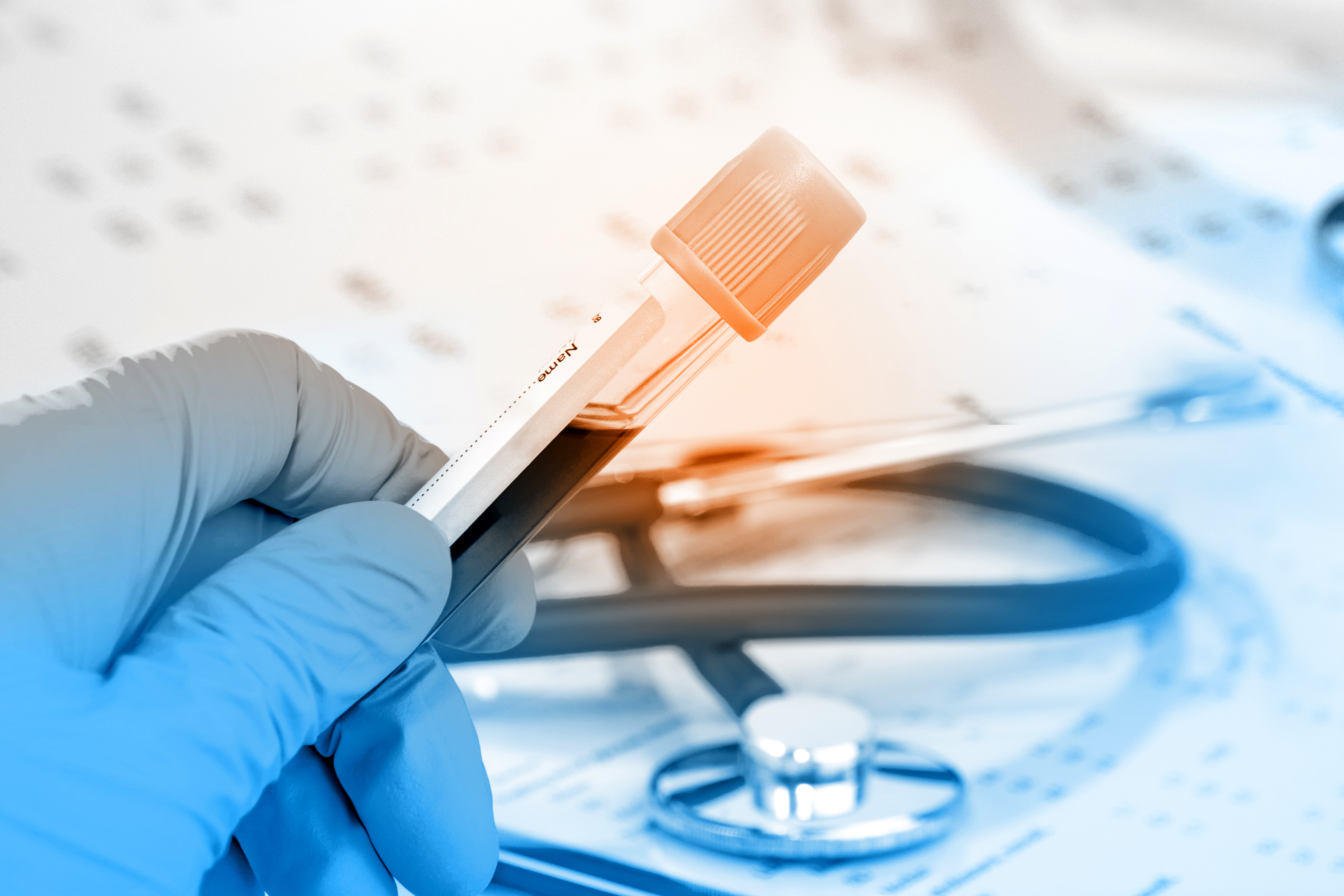 Blood sample testing